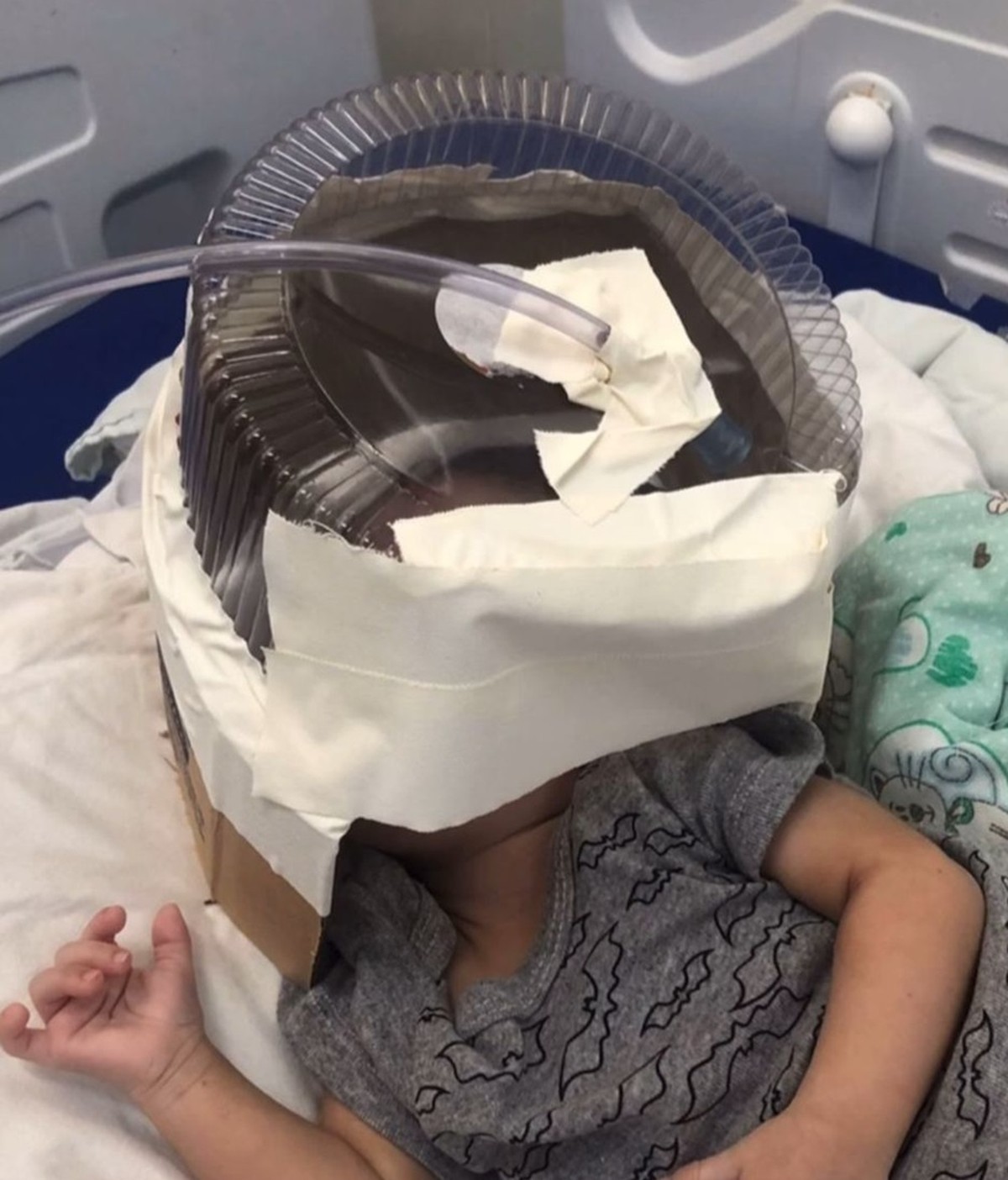 Bebê que precisou de máscara de oxigênio improvisada com embalagem de bolo tem alta da UTI em Natal | Rio Grande do Norte