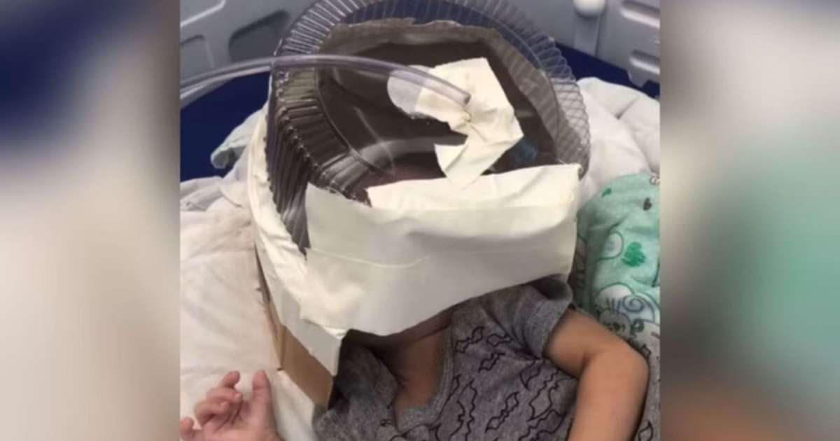 Bebê que usou embalagem de bolo como máscara de oxigênio tem alta da UTI