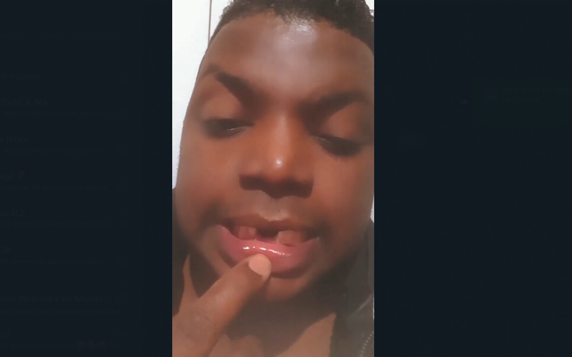 Besouro Pagodinho é agredido durante festa e perde dois dentes